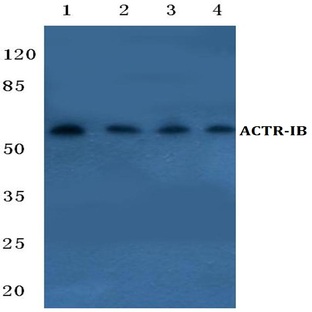 ACTR-IB (G111) pAb