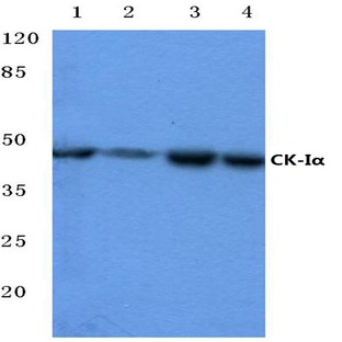 Casein Kinase I(alpha) (F158) pAb