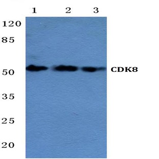 CDK8 (H34) pAb