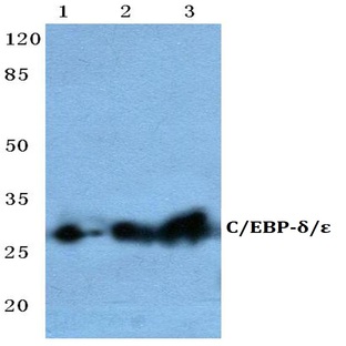 C/EBP-(delta)/E (A217) pAb