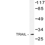 TRAIL (S63) pAb