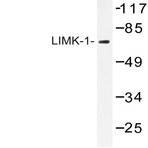 LIMK1 (Q491) pAb