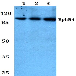 EphB4 (E601) pAb