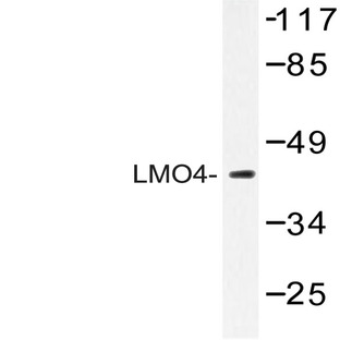 LMO4 (E138) pAb