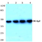 Casein Kinase I(gamma)2 (G7) pAb