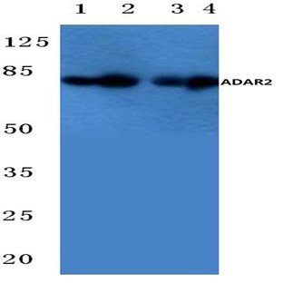 ADAR2 (R510) pAb