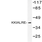 KKIALRE (N301) pAb