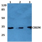 CREM (I106) pAb