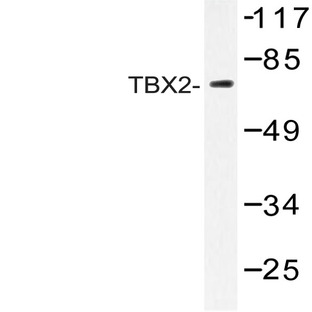 TBX2 (N280) pAb