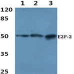 Bs2057_wb