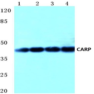 CARP (A243) pAb