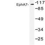 EphA7 (E477) pAb