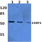 Bs2076_wb