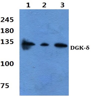 DGK-(delta) (S66) pAb