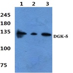 DGK-(delta) (S66) pAb