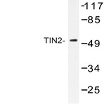 TIN2 (V94) pAb