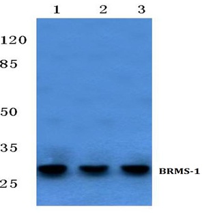 BRMS-1 (E43) pAb