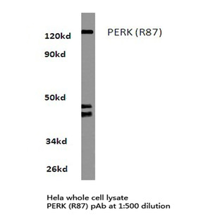 PERK (R87) pAb