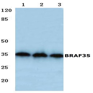 BRAF35 (T29) pAb