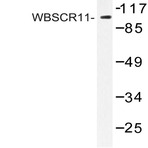 WBSCR11 (K94) pAb