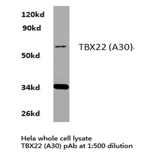 TBX22 (A30) pAb