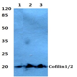 Cofilin1/2 (T88) pAb