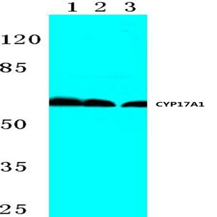 CYP17A1 (N249) pAb