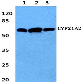 CYP21A2 (F177) pAb