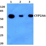 CYP2A6 (E131) pAb