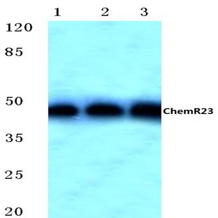 ChemR23 (R249) pAb