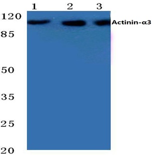 Actinin-(alpha)3 (E25) pAb