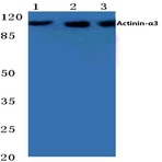 Actinin-(alpha)3 (E25) pAb