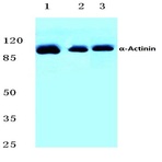 Actinin-(alpha)1/2/3/4 (W48) pAb