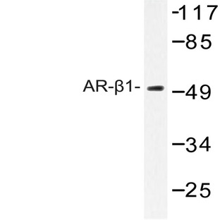 AR-(beta)1 (A302) pAb