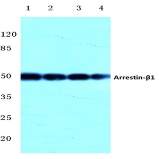 Arrestin-(beta)-1 (Q394) pAb