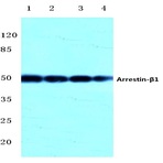 Arrestin-(beta)-1 (Q394) pAb