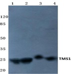 TMS1 (E13) pAb