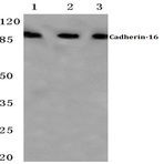 Cadherin-16 (M810) pAb