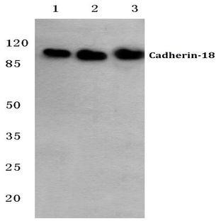 Cadherin-18 (Q129) pAb