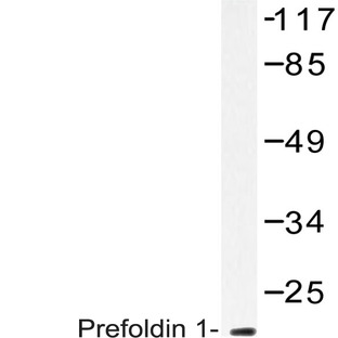 Prefoldin 1 (E35) pAb