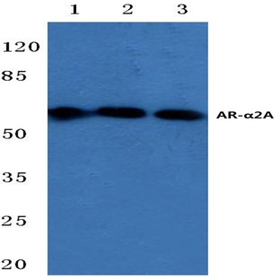 AR-(alpha)2A (R361) pAb