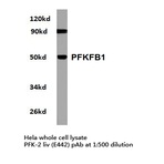 PFKFB1 (E442) pAb