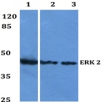 Bs2265_wb