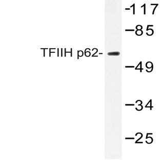 TFIIH p62 (A32) pAb