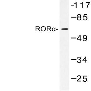 ROR(alpha) (G41) pAb