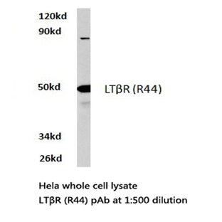 LT(beta)R (R44) pAb