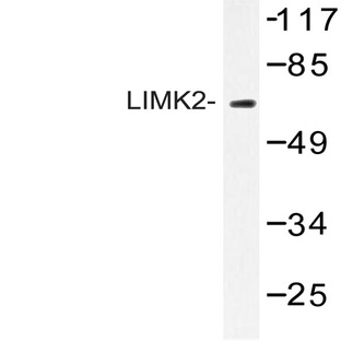 LIMK2 (K491) pAb