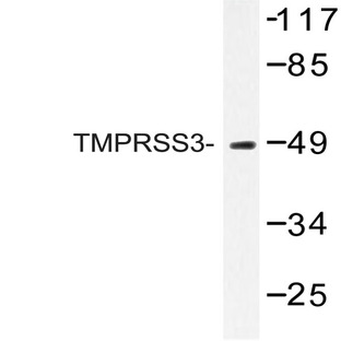 TMPRSS3 (F440) pAb