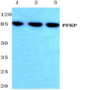 PFKP (Q365) pAb