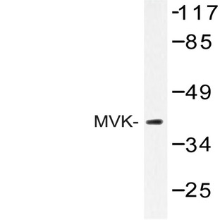 MVK (N175) pAb